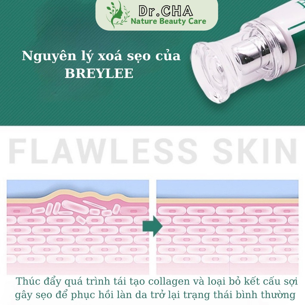 BREYLEE Kem Xoá Mờ Sẹo Hỗ Trợ Xoá Mờ Sẹo Lồi, Lõm, Bỏng Bô, Thuỷ Đậu 30g