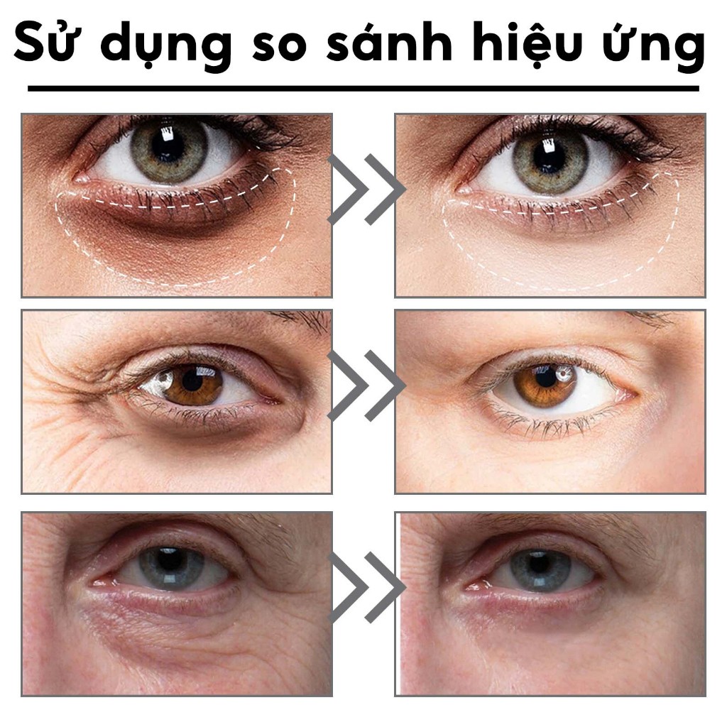 Kem dưỡng mắt EELHOE Niacinamide giảm quầng thâm nếp nhăn cấp ẩm dưỡng da quanh mắt và phục hồi da