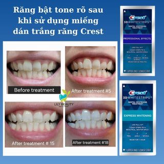 [Combo 7] Miếng dán trắng răng Crest 3D White Professional Effects - Dán trắng răng dành cho răng thường