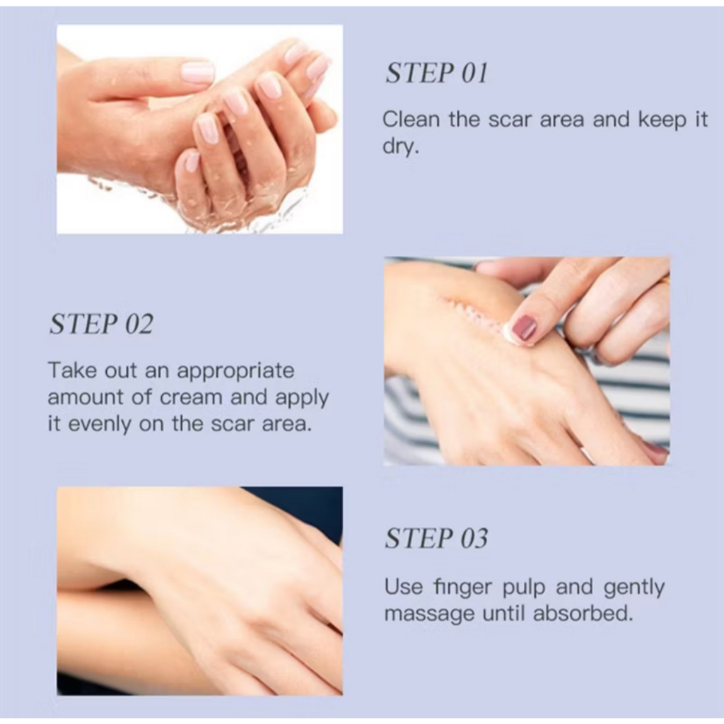 Kem serum xóa sẹo  làm mờ sẹo lồi sẹo lồi sẹo rỗ sẹo thâm mụn sẹo lồi sẹo lõm b5 gôngei 60gr rồi lâu năm nhanh chóng tại
