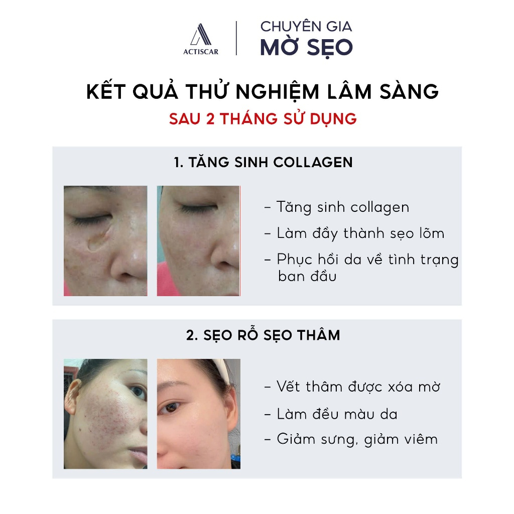 Kem Sẹo Và Serum Chuyên Sâu Lấp đầy Sẹo Rỗ, Sẹo Lõm, Xóa Sạch Sẹo Thâm Lâu Năm Actiscar