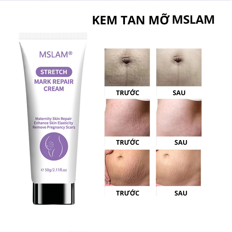 Combo Bộ 3 Chăm Sóc Sắc Đẹp Cho Mẹ Sau Sinh An Toàn Hiệu Quả Kem Nám Tàn Nhang ,Rạn Da , Kem Tan Mỡ