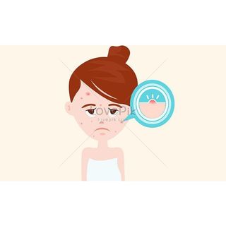 Kem làm sạch mụn khẩn cấp BALEA tuýp 15ml