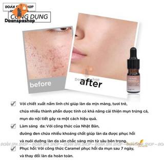 Tinh chất detox CARAMEL 5ml