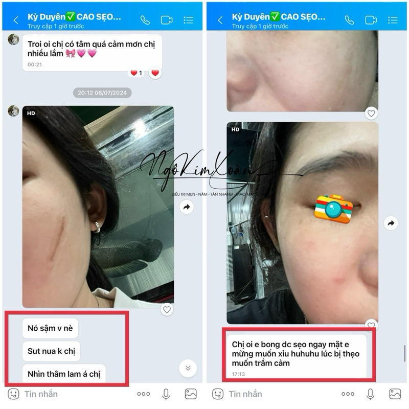 Cao Ủ  Sẹo Collagen , Kem Sẹo Thâm, Rỗ Collagen Tươi Dr.EvaMoon