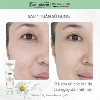 Tẩy tế bào chết mặt Evoluderm thiên nhiên thuần chay giúp làm sạch da, giảm mụn, trắng da 150ml (QT)