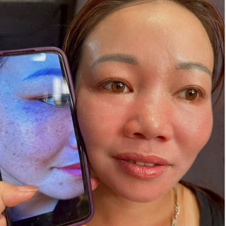 [Chính hãng].Chấm tàn nhang Yody Phương Anh