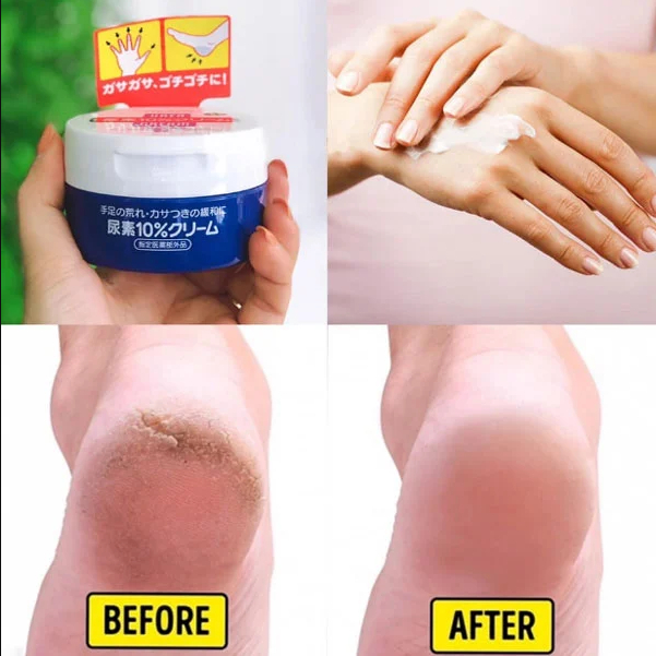 Kem nẻ chân tay Shiseido Urea Cream 100g Nhật Bản