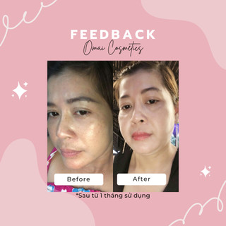 Kem Đa Chức Năng Omai Dưỡng Trắng Ngày Đêm Mờ Sẹo Thâm Mụn Nám Chống Nắng Da Trắng Hồng Căng Mịn