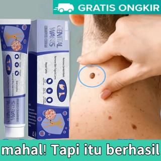 [Loại xịn] serum gel tẩy nốt ruồi xoá mụn,tàn nhang,mụn cóc,mụn thịt,mụn cơm tại nhà an toàn và ngừa sẹo lồi thâm...