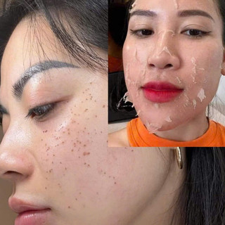 [Chính hãng].Srum tái tạo YODY Phương Anh