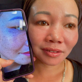 [Chính hãng].Srum tái tạo YODY Phương Anh