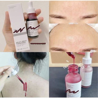 Serum tẩy tế bào chết hoá học AHA, BHA làm sạch sâu và sáng da