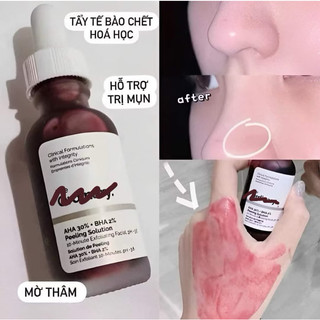 Serum tẩy tế bào chết hoá học AHA, BHA làm sạch sâu và sáng da