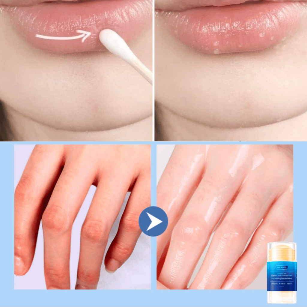 Kem dưỡng ẩm Eourhsa chống nứt nẻ đa năng - Giúp dưỡng ẩm môi, da tay, gót chân, không còn bị khô nứt, cho làn da mịn