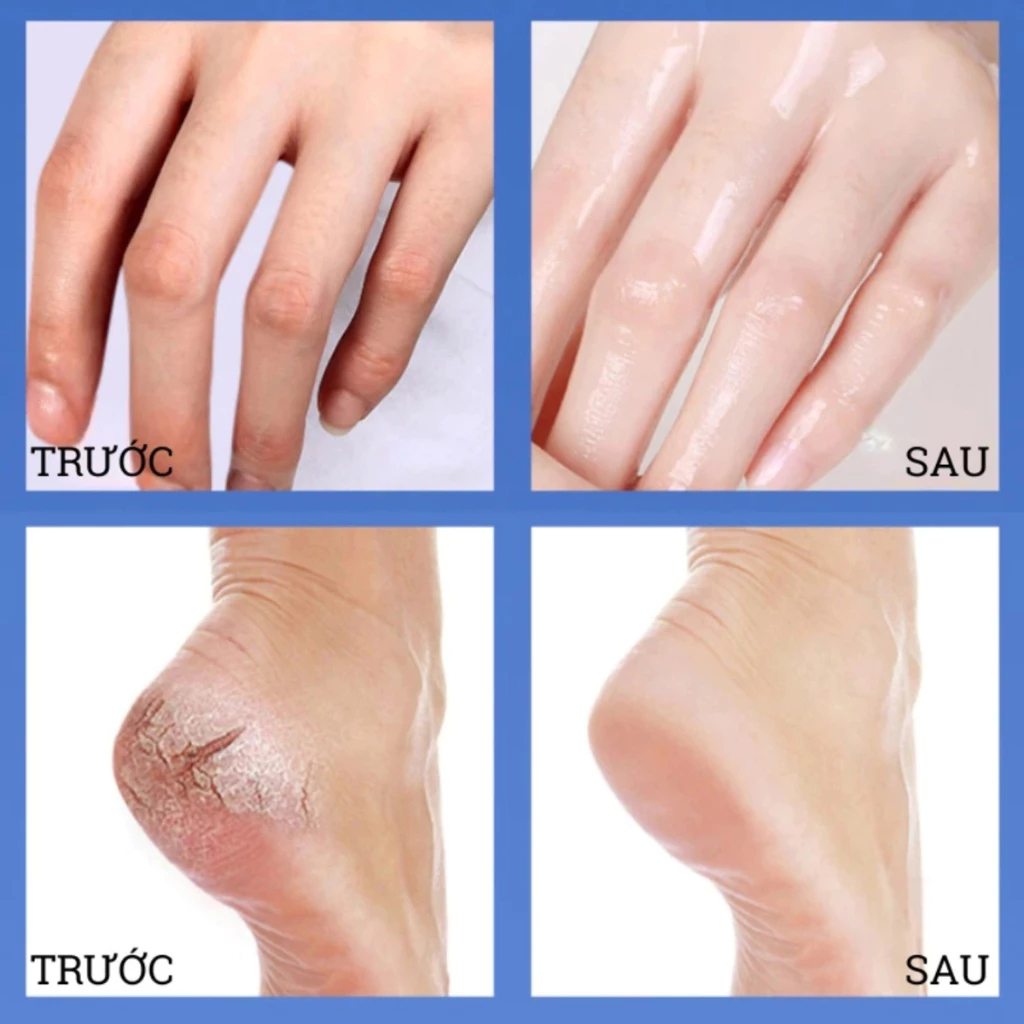Kem Bôi Nứt Nẻ MAIGOOLE Tái Tạo Phục Hồi Da Giúp Dưỡng Ẩm Tay, Chân, Gót Chân Mềm Mịn Da 150g