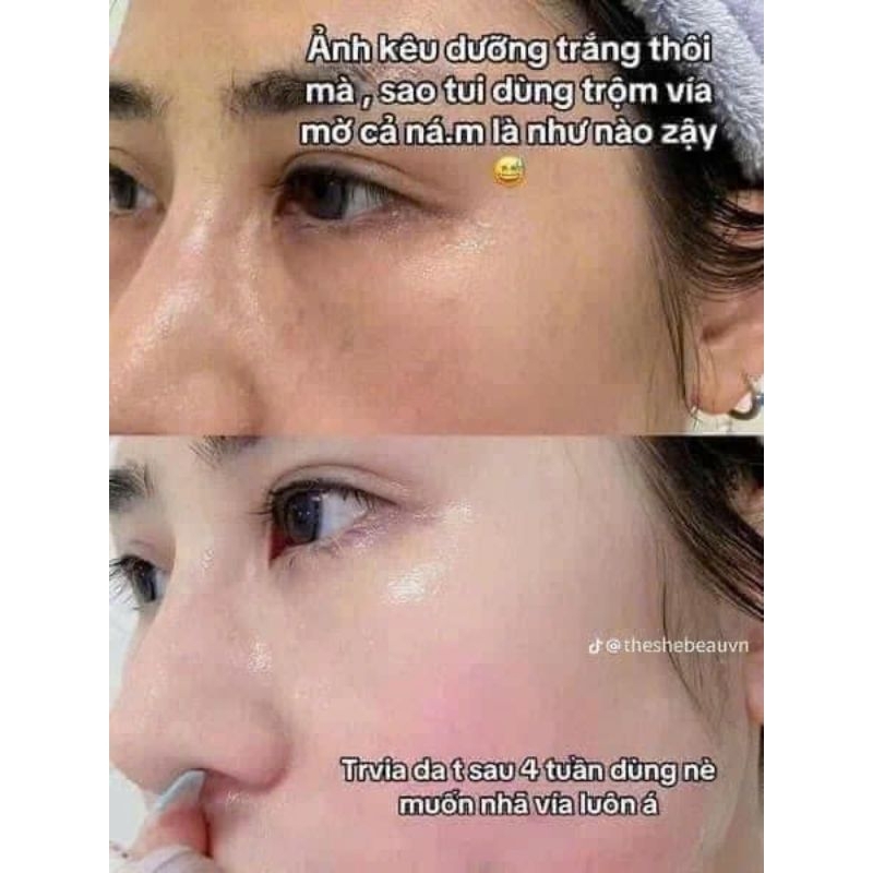 KEM DƯỠNG TRẮNG DA ARBUTIN 5.0 WHITENING CREAM 5% TOSOWOONG - 50ML ( NHẬP KHẨU )
