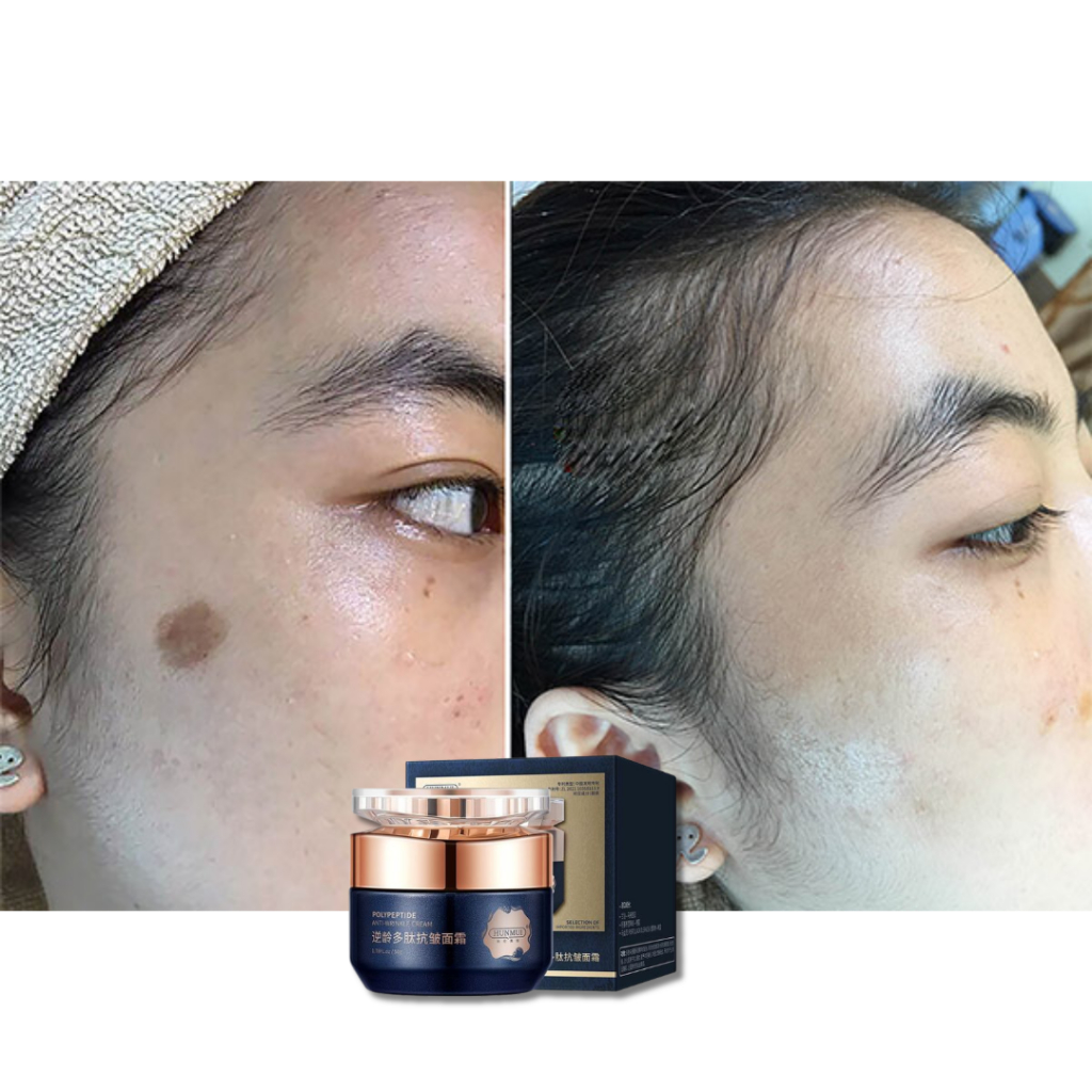 Kem bôi xóa nhăn mờ nám Hunmui - Giúp cải thiện nếp nhăn, mờ nám tàn nhang, cho làn da tươi trẻ trắng sáng đều màu