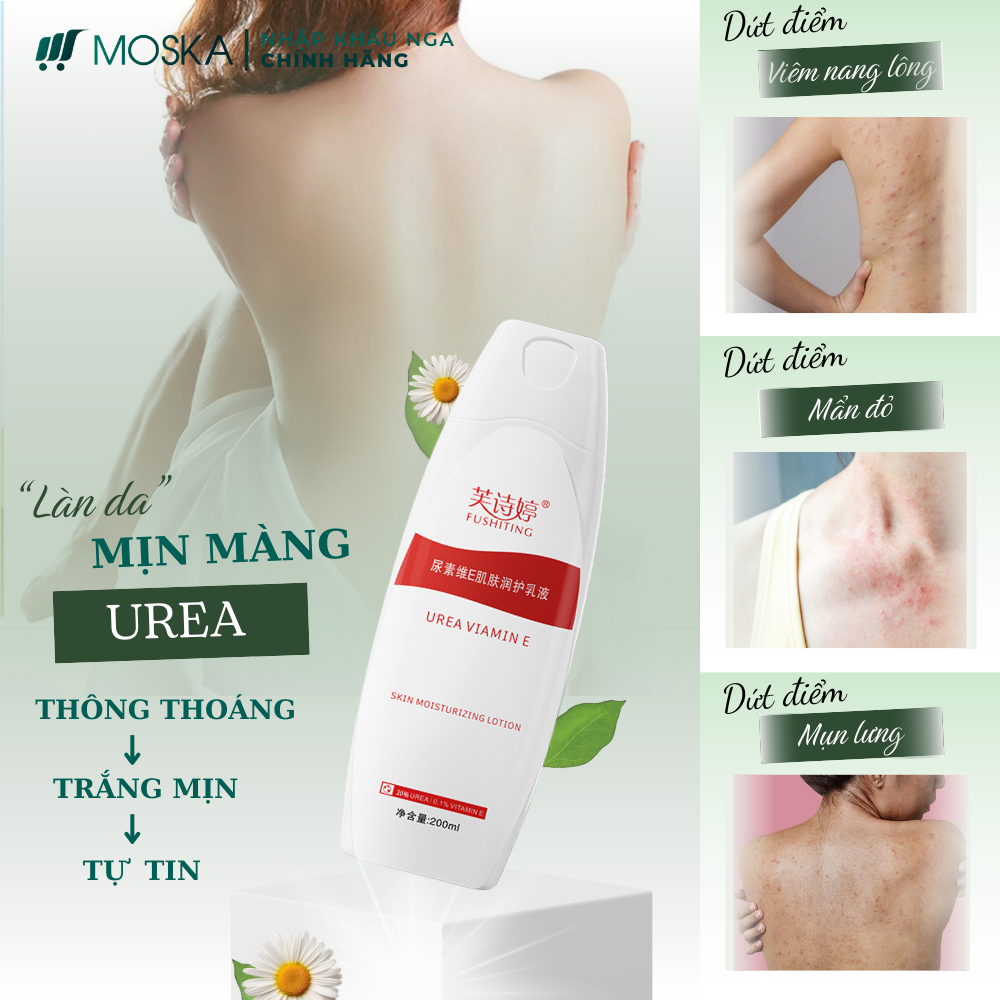 KEM DA LIỄU UREA – GIẢI PHÁP GIẢM VIÊM NANG LÔNG, THÔNG THOÁNG LỖ CHÂN LÔNG, ĐÁNH BAY CHO DA SÁNG MỊN MÀNG 200ML | Moska