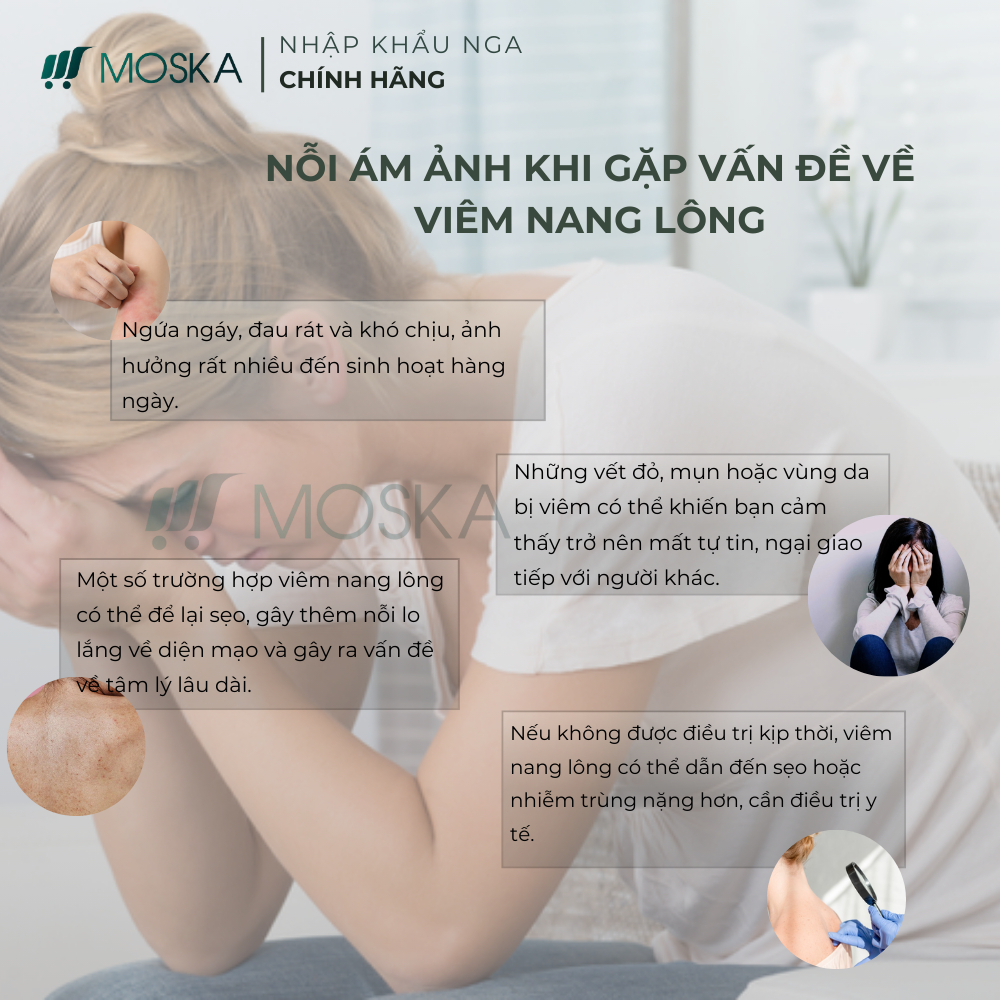 KEM DA LIỄU UREA – GIẢI PHÁP GIẢM VIÊM NANG LÔNG, THÔNG THOÁNG LỖ CHÂN LÔNG, ĐÁNH BAY CHO DA SÁNG MỊN MÀNG 200ML | Moska