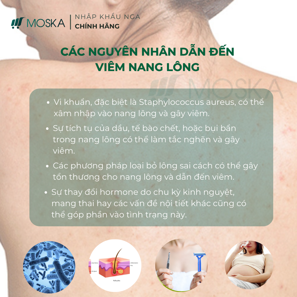 KEM DA LIỄU UREA – GIẢI PHÁP GIẢM VIÊM NANG LÔNG, THÔNG THOÁNG LỖ CHÂN LÔNG, ĐÁNH BAY CHO DA SÁNG MỊN MÀNG 200ML | Moska