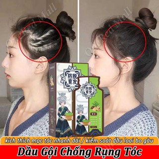 Dầu Gội Trị Rụng Tóc Dầu Gội Mọc Tóc Nhanh Giảm Gãy Rụng Nơi Rụng Tóc Dầu Gội Kích Thích Mọc Tóc Dưỡng Tóc