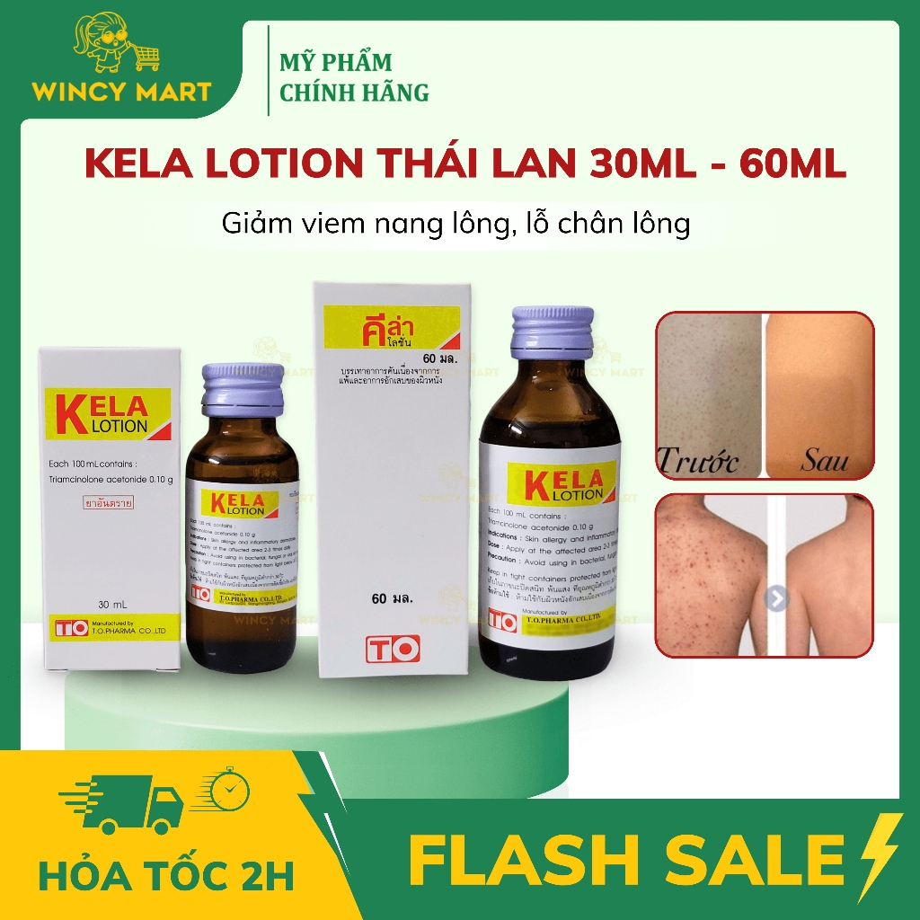 [Hàng Thái Lan] Kela Lotion Dùng Cho Da Viêm Lỗ Chân Lông Giúp Da Mịn Màng Chính Hãng 30ML/60ML
