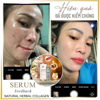Serum Collagen Thủy Triều
