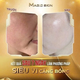Siêu Kim Căng  Bóng Đa Tầng MAGIC SKIN