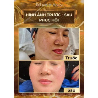 Siêu Kim Căng  Bóng Đa Tầng MAGIC SKIN