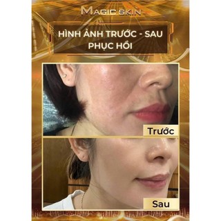 Siêu Kim Căng  Bóng Đa Tầng MAGIC SKIN
