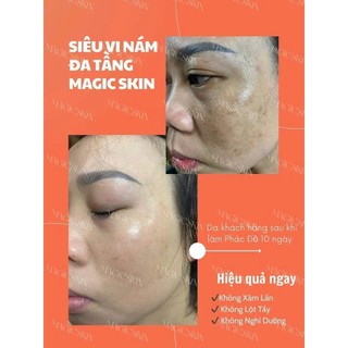 Siêu Kim Căng  Bóng Đa Tầng MAGIC SKIN