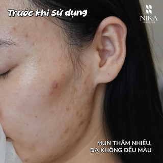 Serum Sáng Da Đều Màu K Dark Spot