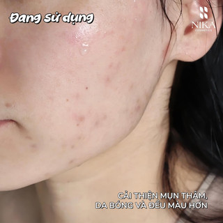 Serum Sáng Da Đều Màu K Dark Spot