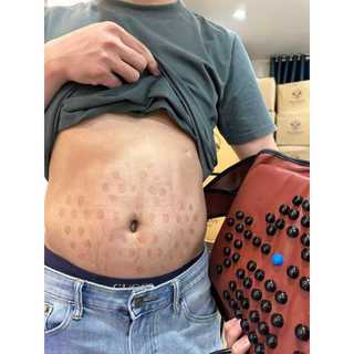 Máy hóa lỏng mỡ bụng, máy giảm béo( kèm 2 đai khi mua máy)