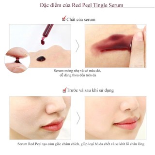 Tinh chất SO NATURAL (Peel Serum/ White Serum)