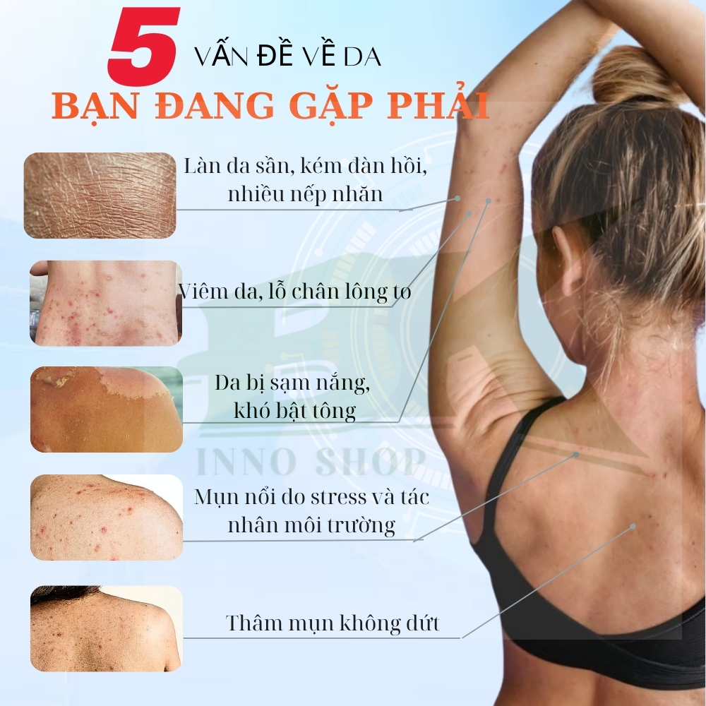 SỮA TẮM HƯƠNG NƯỚC HOA D'MONS CARE (500mL) SỮA TẮM LÀM SẠCH SÂU, DƯỠNG ẨM, GIẢM THÂM MỤN, NÂNG TONE DA HIỆU QUẢ| BK INNO