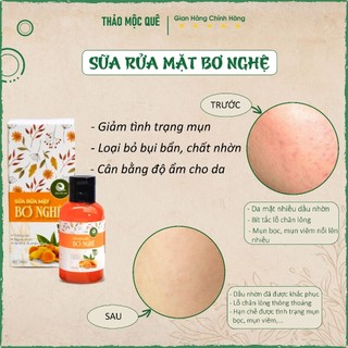 [ MẪU MỚI ] Sữa Rửa Mặt Bơ Nghệ Thảo Mộc Quê Trắng Da Ngừa Mụn Se Khít Lỗ Chân Lông 140ml