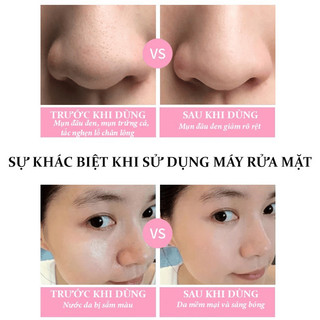 Máy rửa mặt SAGOKER