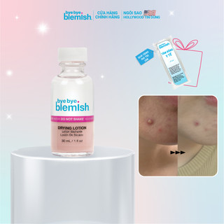 Chấm Mụn Giảm Mụn Nhanh Sau 1 Đêm Dành Cho Mụn Trắng, Sưng Đỏ, Da Nhạy Cảm Bye Bye Blemish Original Drying Lotion 30ml