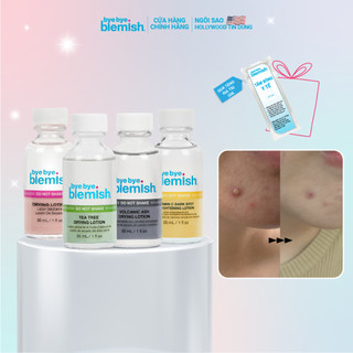 Chấm mụn giảm mụn nhanh sau 1 đêm Bye Bye Blemish Drying Lotion 30ml cho tất cả loại mụn trên mặt