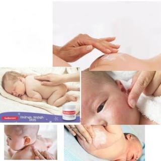 Kem hăm tã Sudocrem