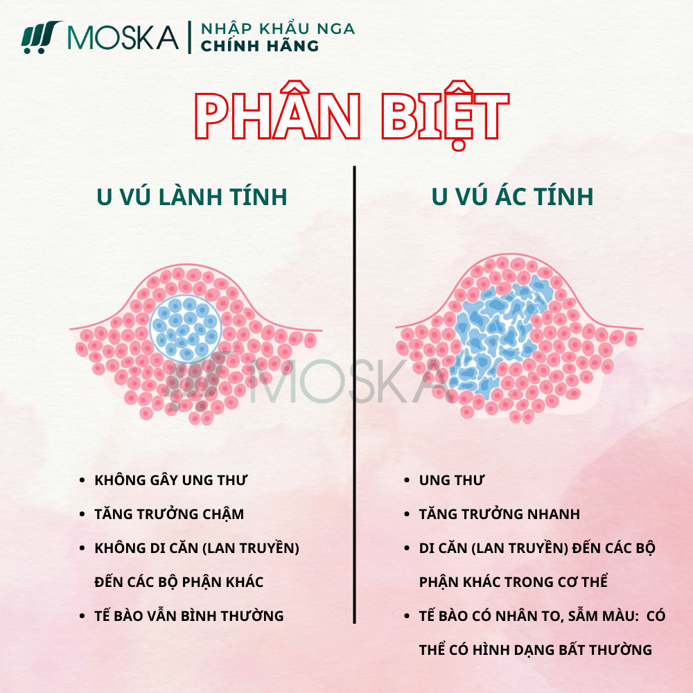 KEM TAN U BƯỚU SENJOKO NHẬT BẢN 50G - GIẢM SƯNG ĐAU HẠCH NÁCH, NGỰC, HỖ TRỢ TAN U BƯỚU SỢI TUYẾN VÚ LÀNH TÍNH | MOSKA