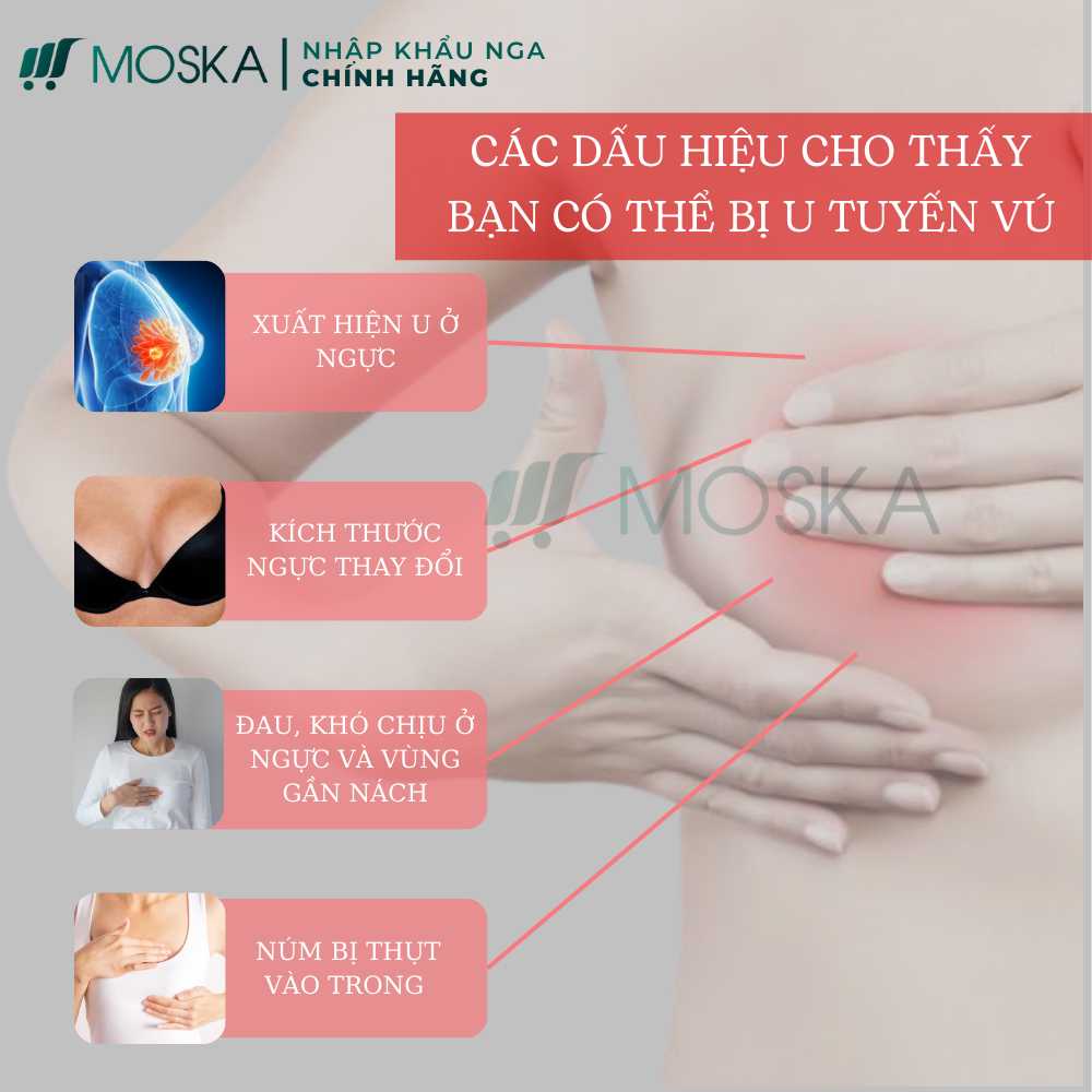 KEM TAN U BƯỚU SENJOKO NHẬT BẢN 50G - GIẢM SƯNG ĐAU HẠCH NÁCH, NGỰC, HỖ TRỢ TAN U BƯỚU SỢI TUYẾN VÚ LÀNH TÍNH | MOSKA