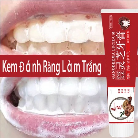 Kem đánh trắng răng kem đánh răng kem trắng răng 120g trắng răng kem đánh răng tẩy cao răng làm trắn