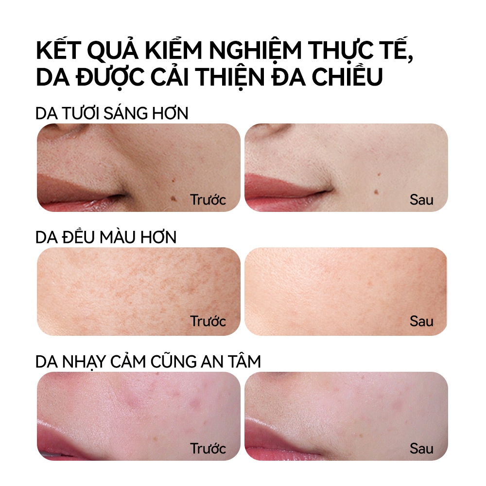 FOCALSKIN Serum Dưỡng Trắng Da Mờ Thâm Mụn Gấp Đôi Vitamin C + Niacinamide B3 +  Alpha Arbutin 30ml | BigBuy360 - bigbuy360.vn