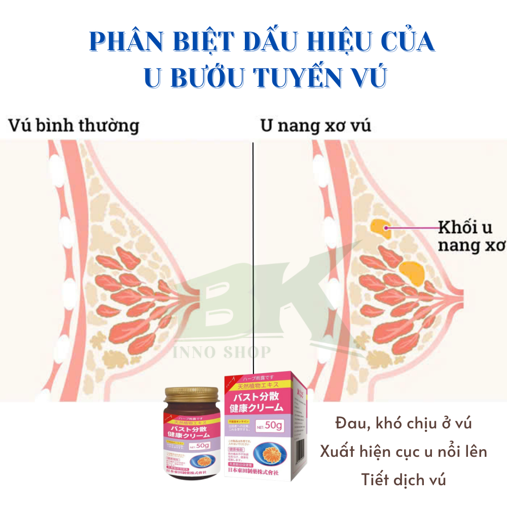 Kem Thảo Dược Tan U Nang Tuyến Vú SENJOKO Nhật Bản 50g - Giảm Đau U Vú, Thu Nhỏ U Nang Lành Tính, Tăng Tuần Hoàn Máu BK