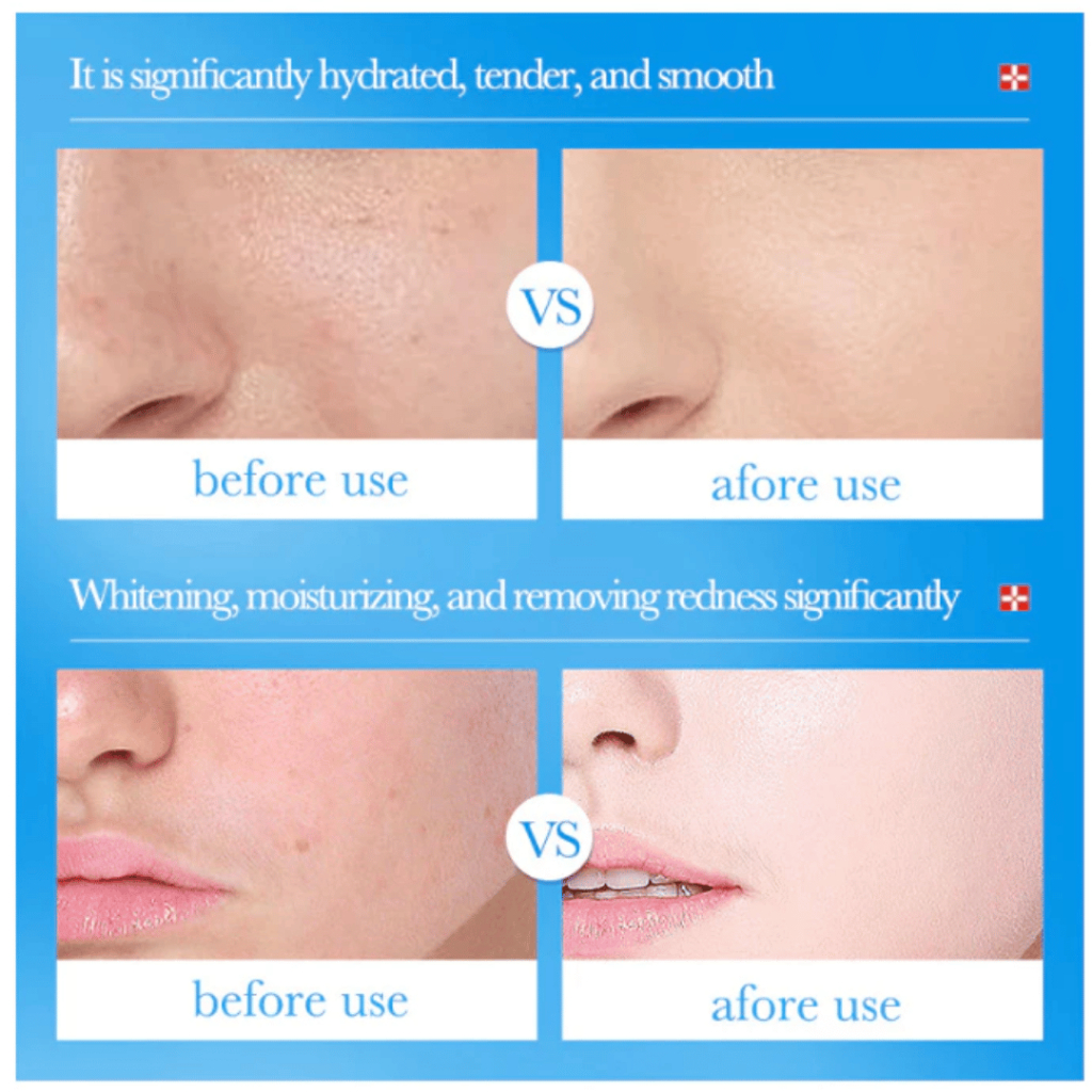 Serum cấp ẩm làm trắng da B5 Bioaqua - Giúp tái tạo da, cấp và dưỡng ẩm da, từ làn da xỉn màu cho đến trắng sáng làn da