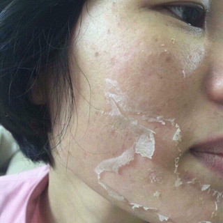 Hộp 10 Set Vi Kim Tảo Biển RONAS Resting Peel