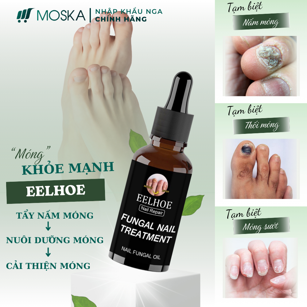 Serum Tri Nấm Móng Tay Chân Hư Khoé EELHOE Mỹ 30ML Phục Hồi Móng Thối, Móng Hư, Giòn Nứt Móng,  Dưỡng Móng Dài | Moska